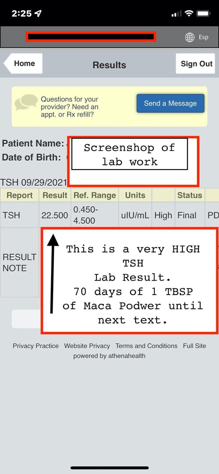 High TSH Lab results 22.5 Natural treatment
